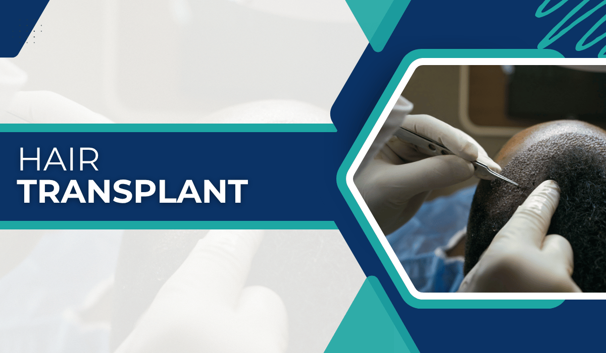 Hair Transplant Turkey