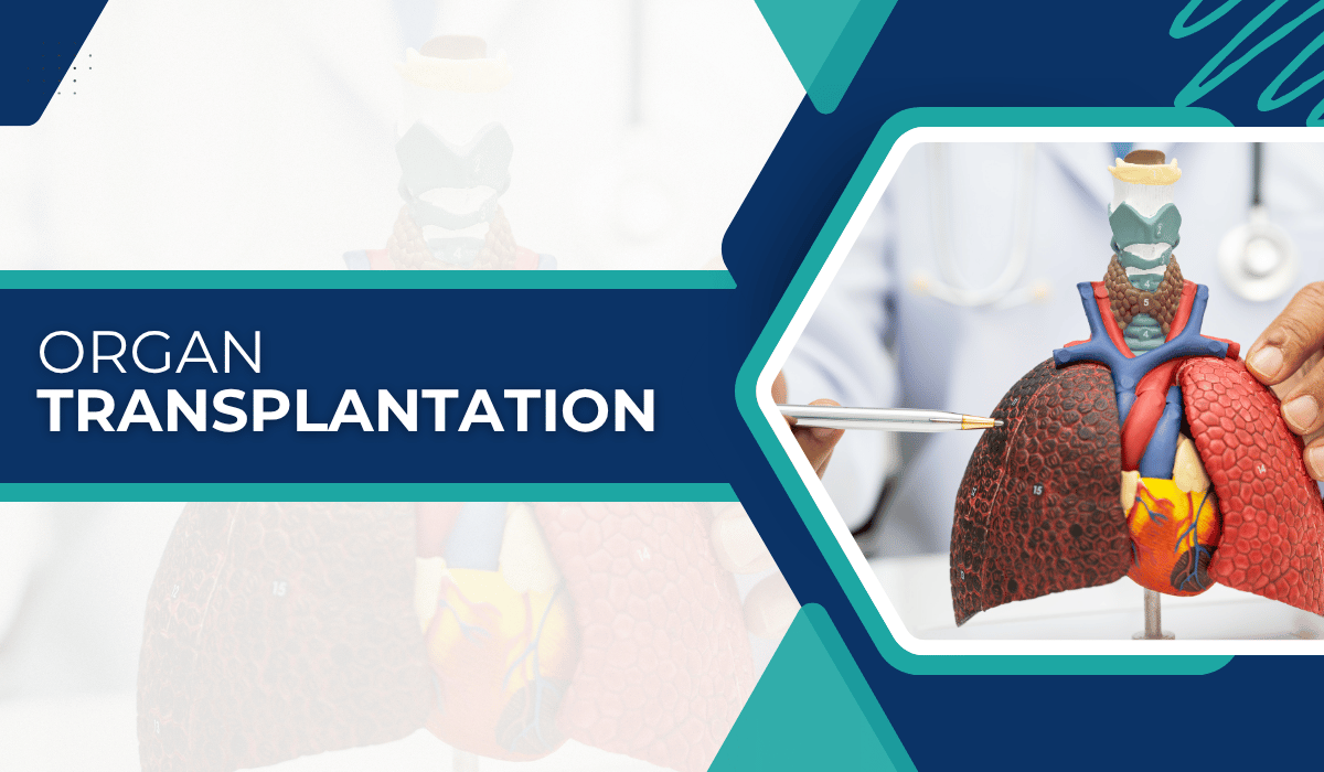 Model illustrating organ transplantation process Organ Transplantation in Turkey