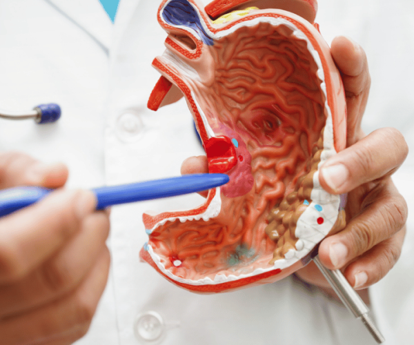 Affordable Countries for Gastric Sleeve Surgery