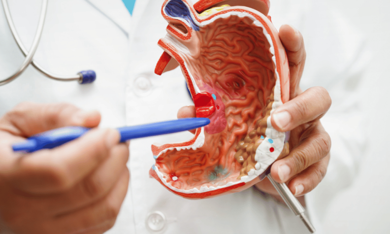 Affordable Countries for Gastric Sleeve Surgery