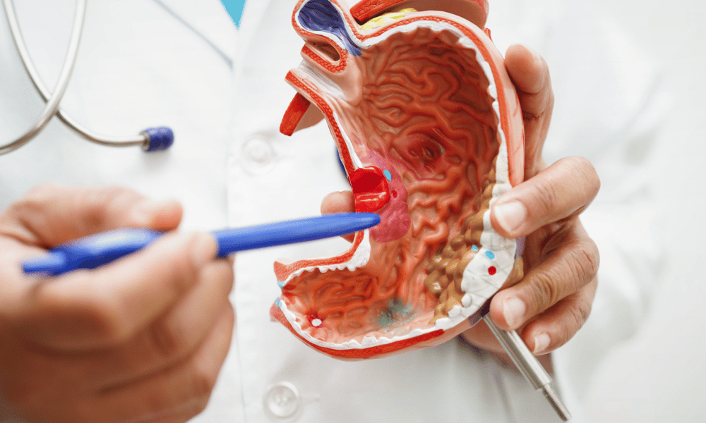 Affordable Countries for Gastric Sleeve Surgery