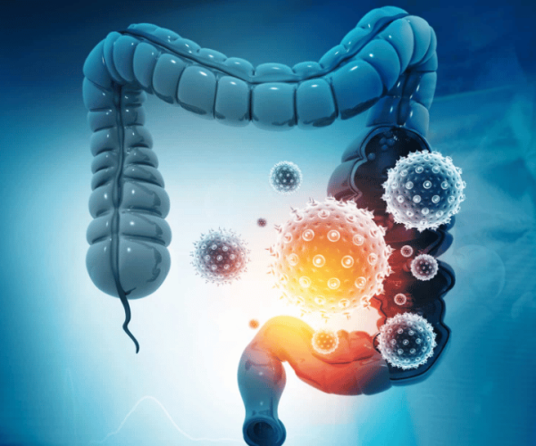 Colon Cancer and Liver