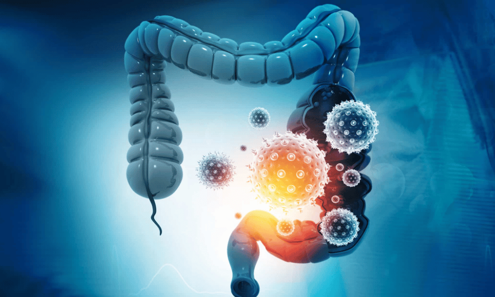 Colon Cancer and Liver