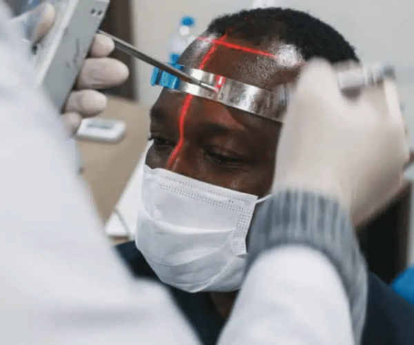 Afro Hair Transplant in Turkey: Specialized Care for Unique Hair