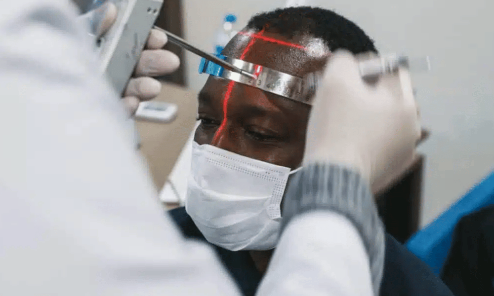 Afro Hair Transplant in Turkey: Specialized Care for Unique Hair