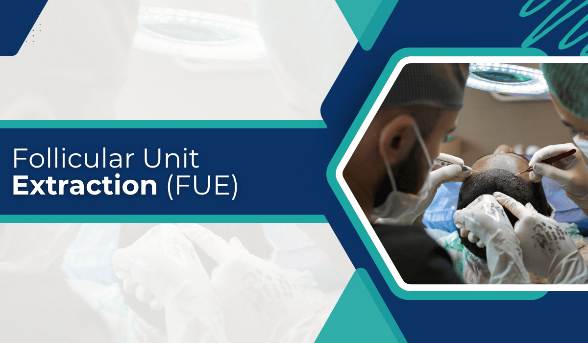 Follicular Unit Extraction (FUE)