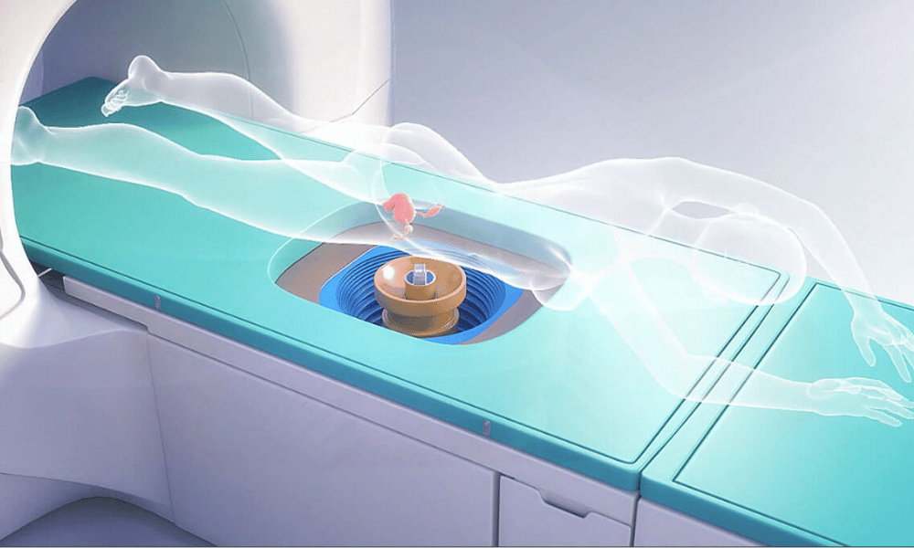 High-Intensity Focused Ultrasound (HIFU)