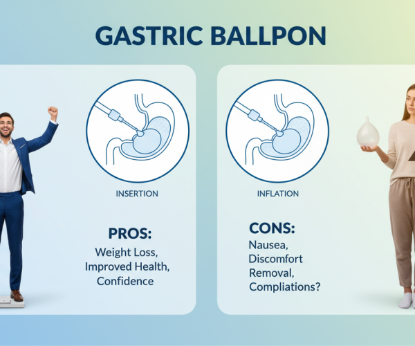 Gastric Balloon Pros and Cons