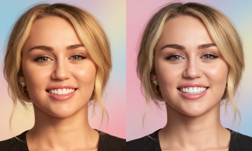 Miley Cyrus Teeth Before and After